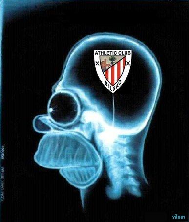 cerebro zurigorri